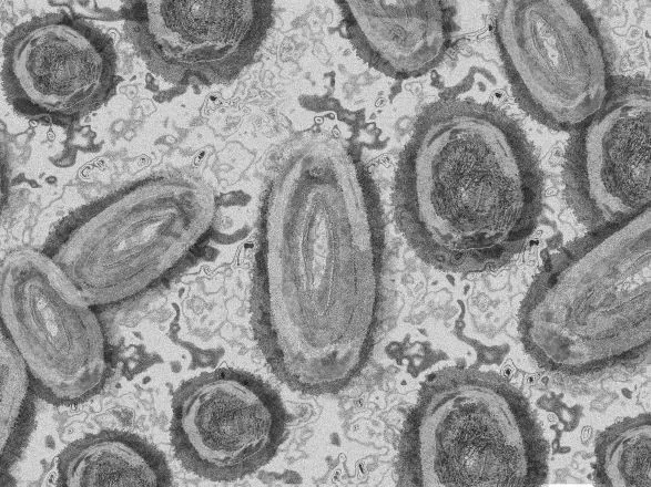 Novo boletim Mpox da Secretaria da Saúde registra 21 casos da doença no Paraná